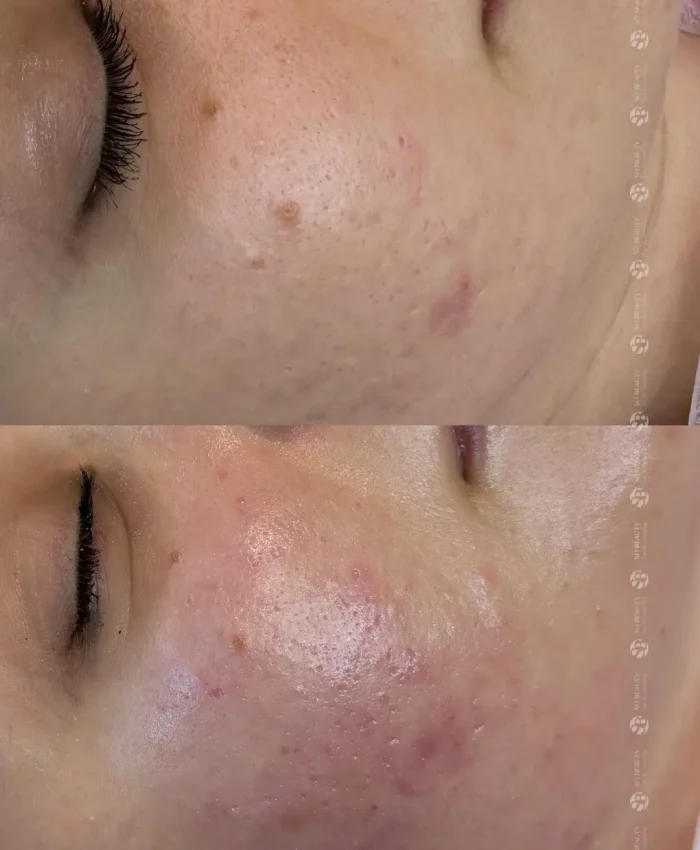 5-3 5-3